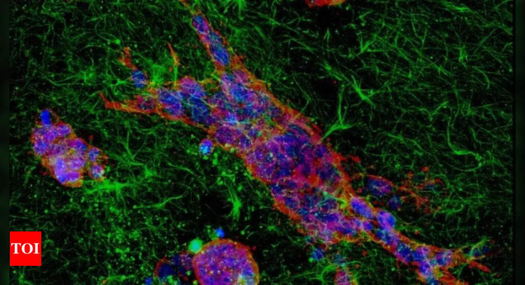 Breakthrough IISc Research Reveals How Cancer Cells Adapt During Metastasis | Bengaluru News