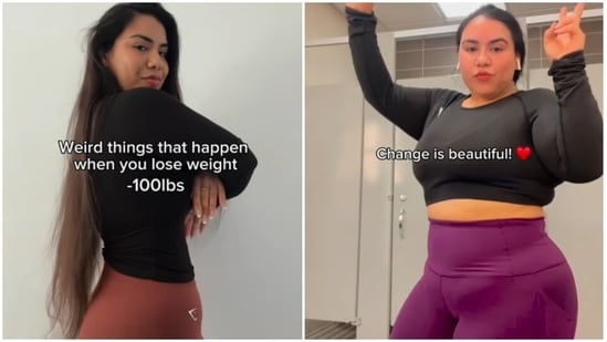Health News Live December 10, 2024 : Woman who shed 45 kg shares weird things that happen to your body after a drastic weight loss