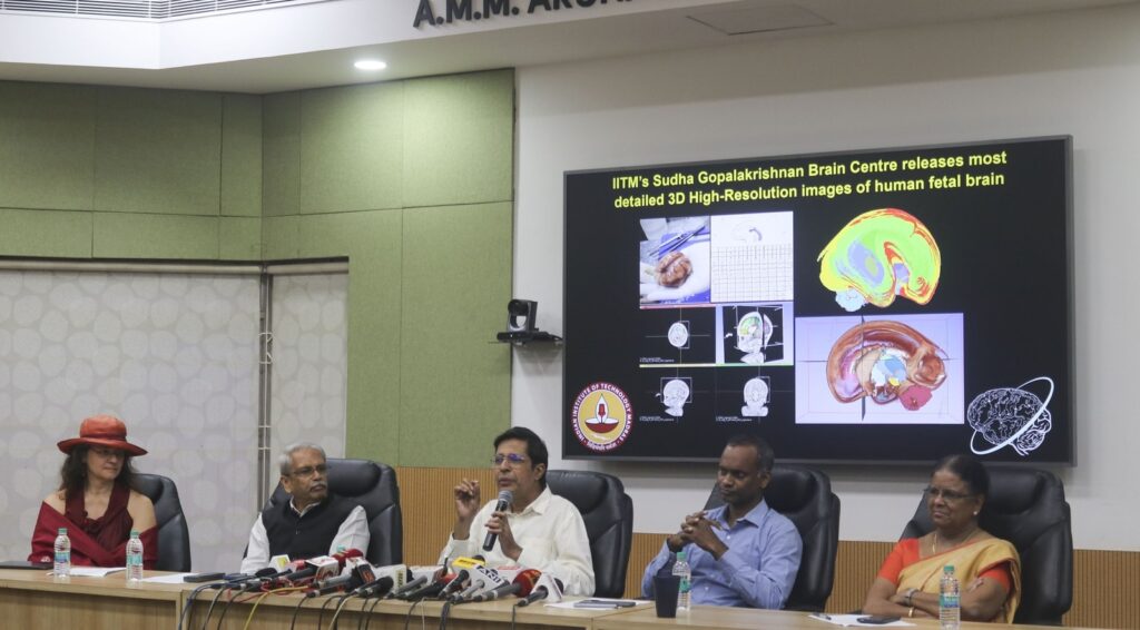 IIT Madras releases detailed 3D high-resolution images of human fetal brain