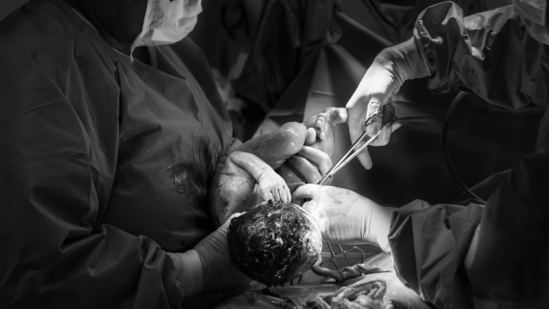 Elective C-section: What is it? Is it safe? Doctor explains | Health