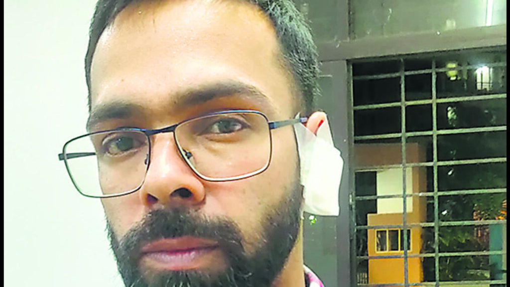 Thane man bites off friend’s ear in fit of anger | Mumbai news