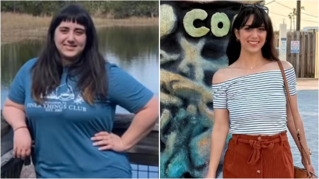 Woman who lost 54 kg reveals mistakes she made on her PCOS weight loss journey: ‘I went 100% gluten and dairy-free’ | Health