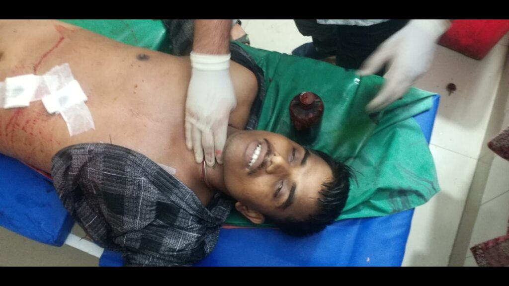 Ara Tanishq showroom loot case accused killed, five cops among seven injured