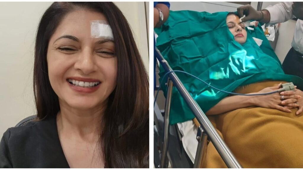Bhagyashree gets injured while playing pickleball, gets 13 stitches on forehead | Bollywood
