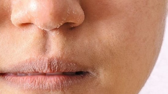 Fasting wrecking your skin? 4 skincare tips to stay glowing during Ramadan and Lent 2025 | Health