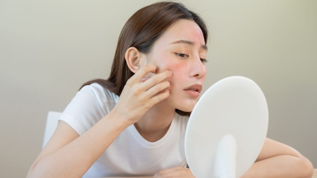 Is your skin barrier damaged? Experts share how to know and what you can do to treat it: Apply sunscreen every day | Health
