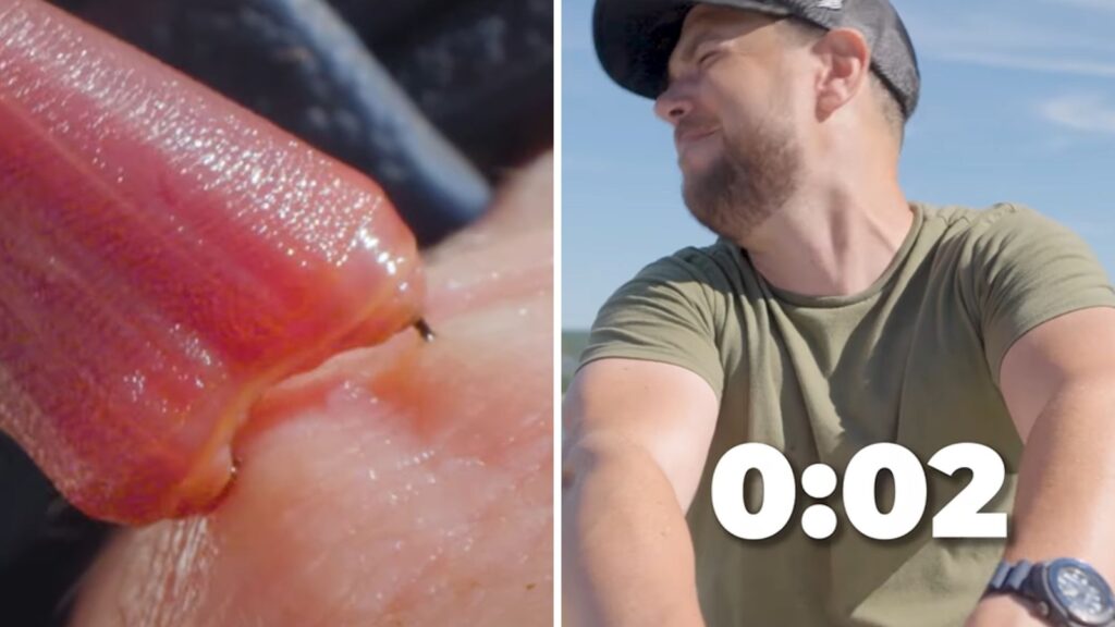 MIT grad willingly puts hand in box filled with venomous bloodworms: ‘Why would you do that?’ | Trending