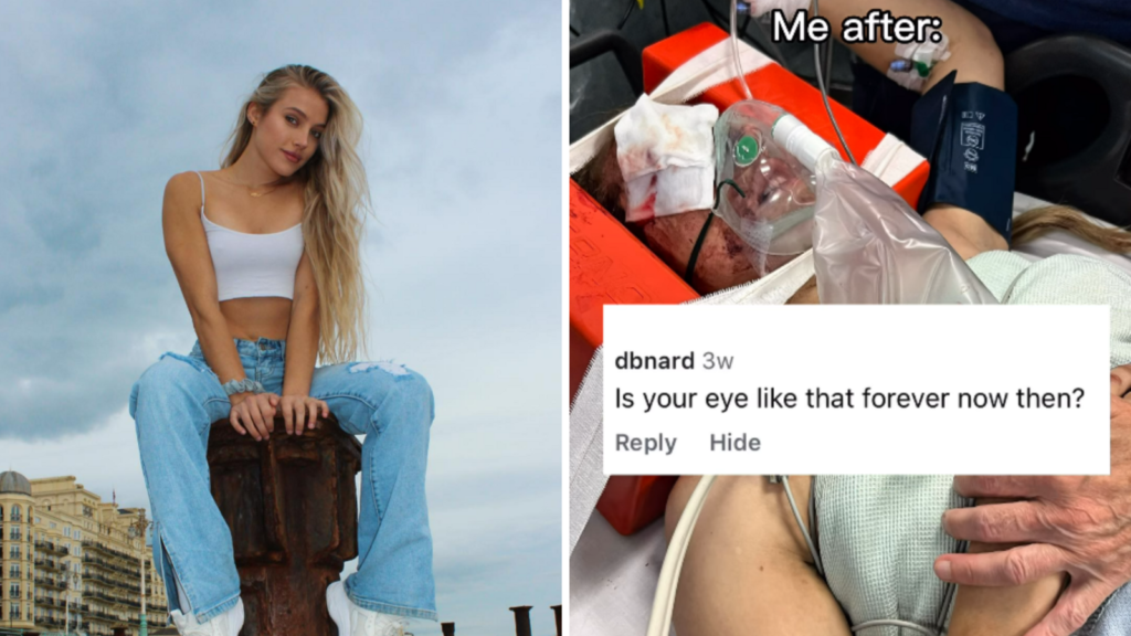 Neuroscientist-turned-OnlyFans model loses memory after freak motorcycle crash with pigeon | Trending