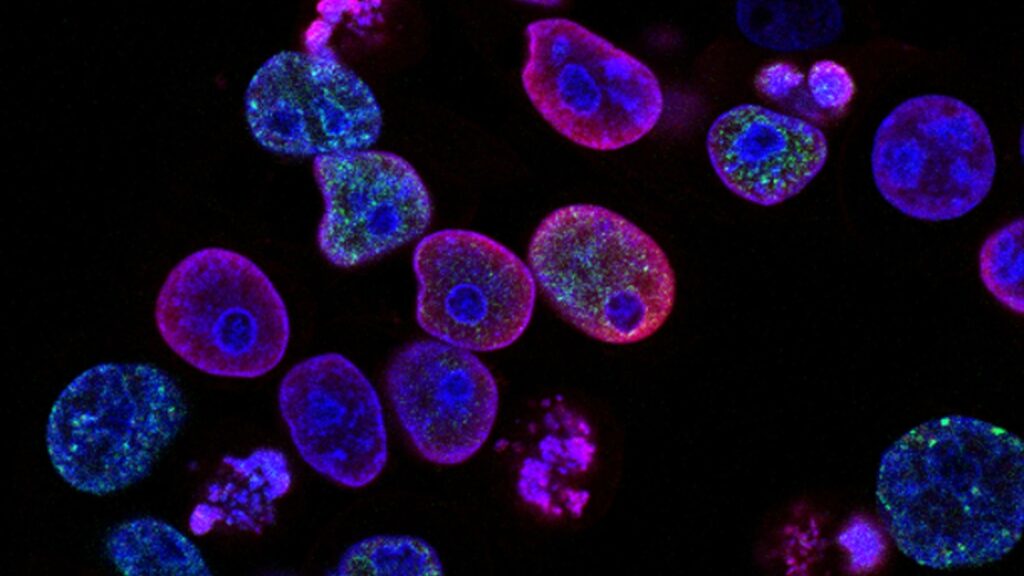 New study reveals a simple genetic approach to tackle aggressive cancers | Health