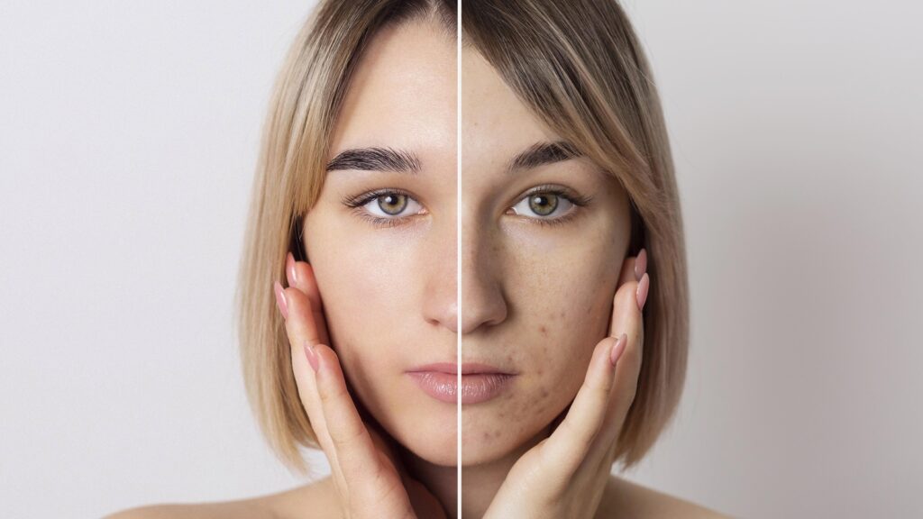 Suffering from hyperpigmentation? Experts reveal which actives and professional treatments to go with | Health