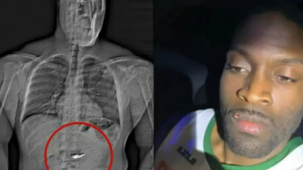 Thief swallows diamond earrings worth ₹6.7 crore to avoid arrest, a nervous question gets him caught | Trending