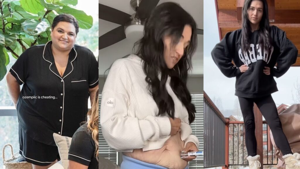 Woman lost 75 kg with Ozempic but her transformation reveals an unexpected struggle | Trending