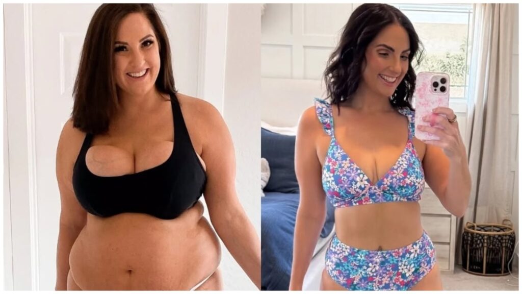 Woman reveals she stopped dieting at 107 kg and then lost 45 kilos; here’s how she did it | Health