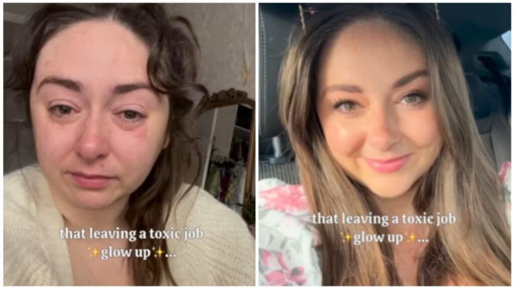 Woman shows incredible glow-up post leaving toxic job that made her feel worthless: ‘My hair was falling, skin was grey’ | Health