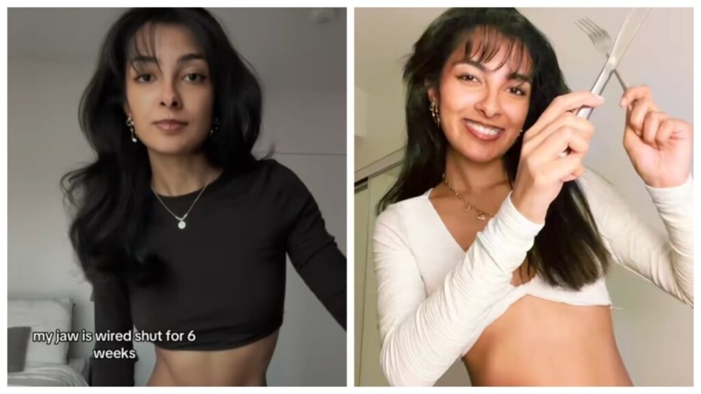 Woman weighing just 42 kg shows weight loss journey after jaw surgery: ‘I haven’t had a single bite of food in 42 days’ | Health
