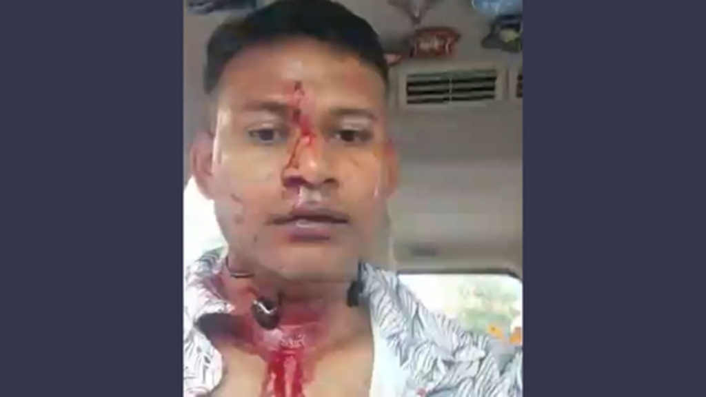 Bengaluru road rage: HC bars police from coercive action against IAF officer Shiladitya Bose | Bengaluru