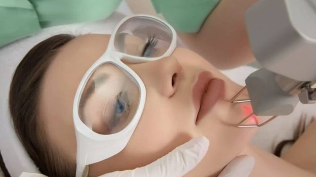 Fractional CO2 Laser: TikTok can’t stop talking about this miracle laser in fighting acne scars but is it safe for skin? | Health