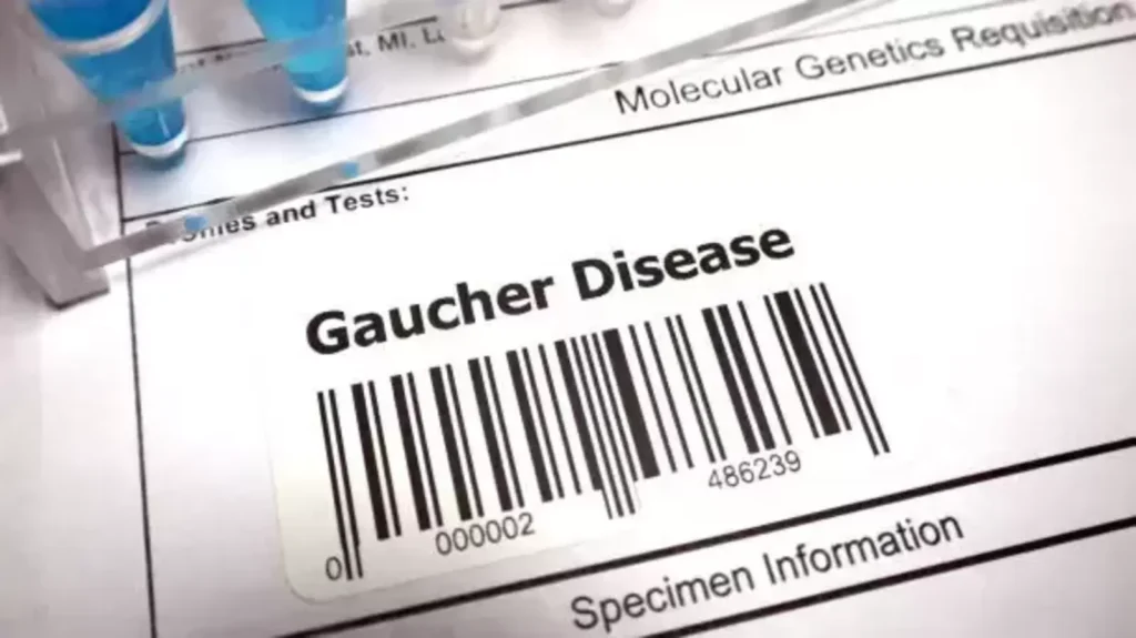 Gaucher disease: What is it? Doctor explains types, symptoms, treatment | Health