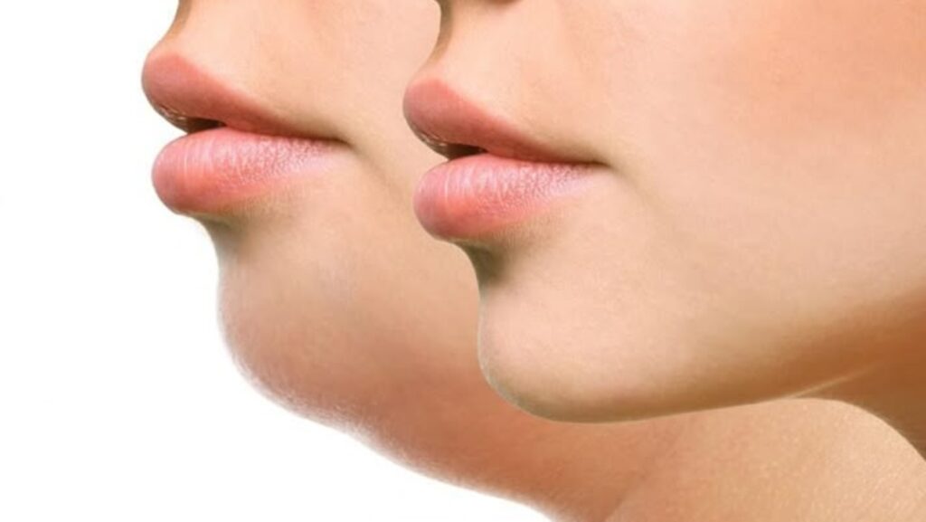 Jawline goals: Experts reveal 4 ways to sculpt a snatched look without surgery | Health