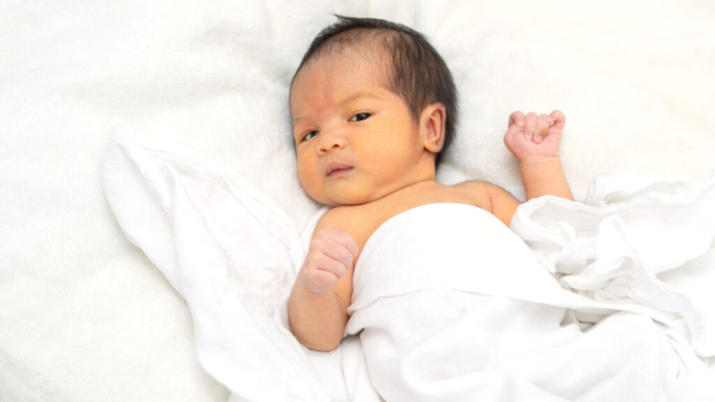 Newborn jaundice: Recognising and managing the symptoms; gynecologist shares | Health