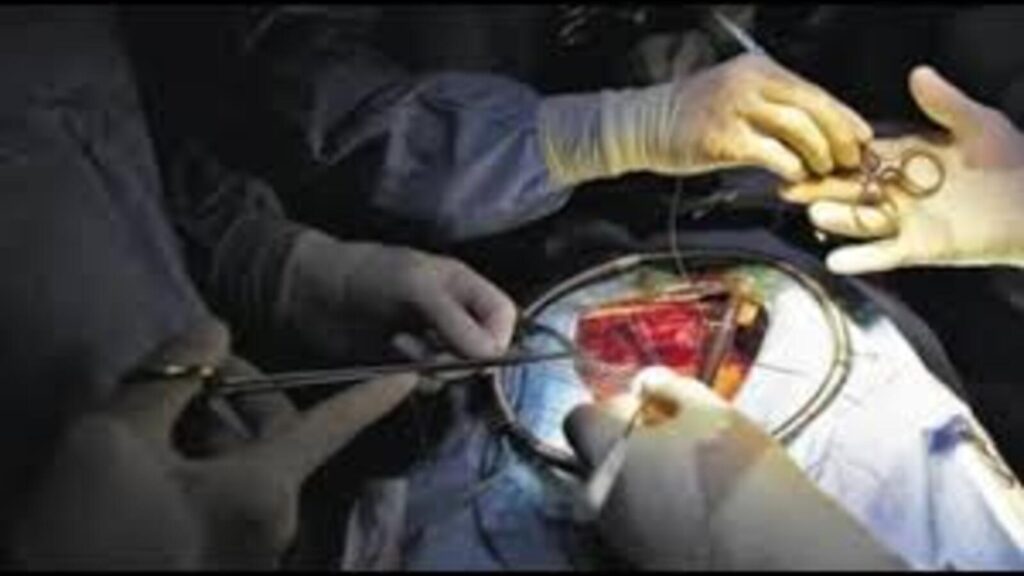 Piece of knife lodged just 0.5 cm from man’s heart removed at KGMU