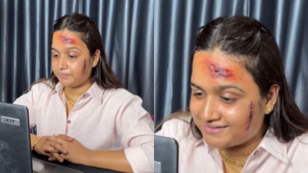 Pune woman shares make-up tutorial to create fake accident scars to trick managers for leave, sparks debate | Trending
