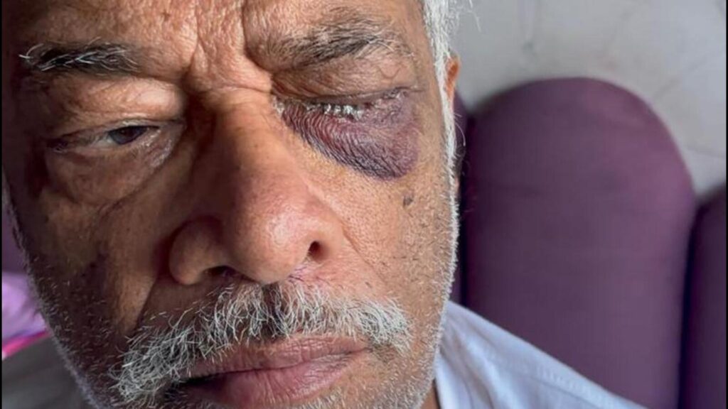 Bizman loses vision after cataract surgery, alleges negligence | Mumbai news