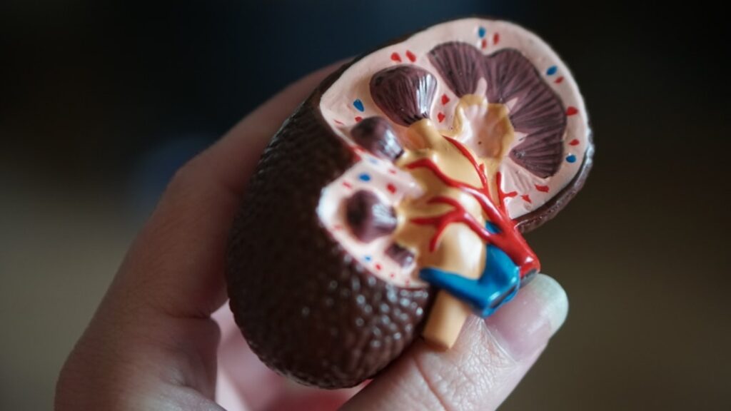 Can summer increase the risk of kidney stones? Doctor shares tips to stay safe | Health