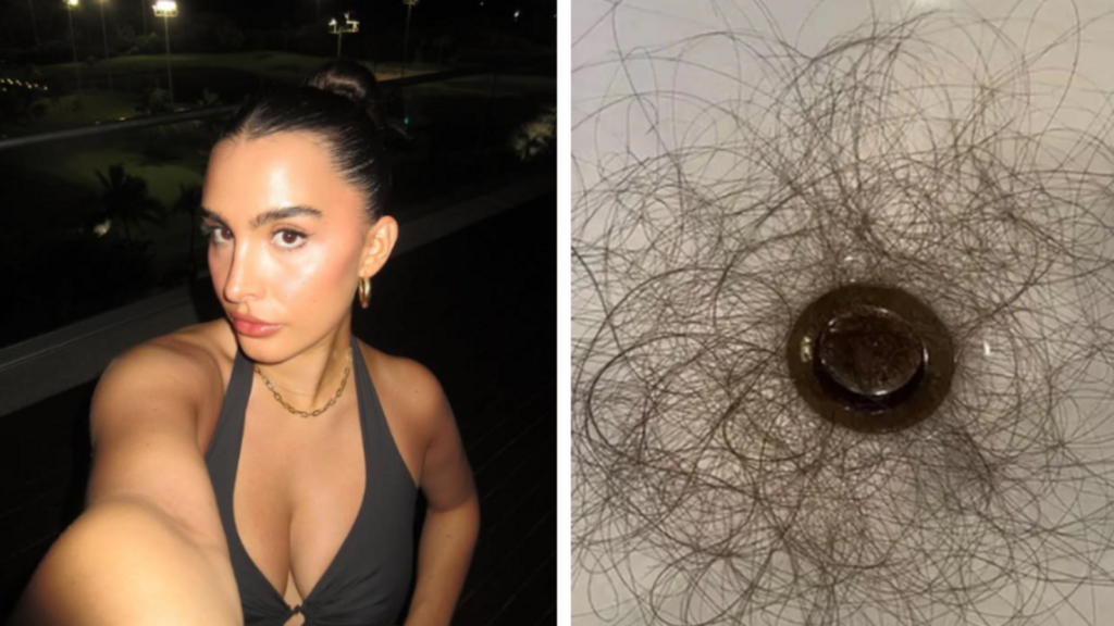 Considering weight loss drugs? Reality star reveals shocking side effect