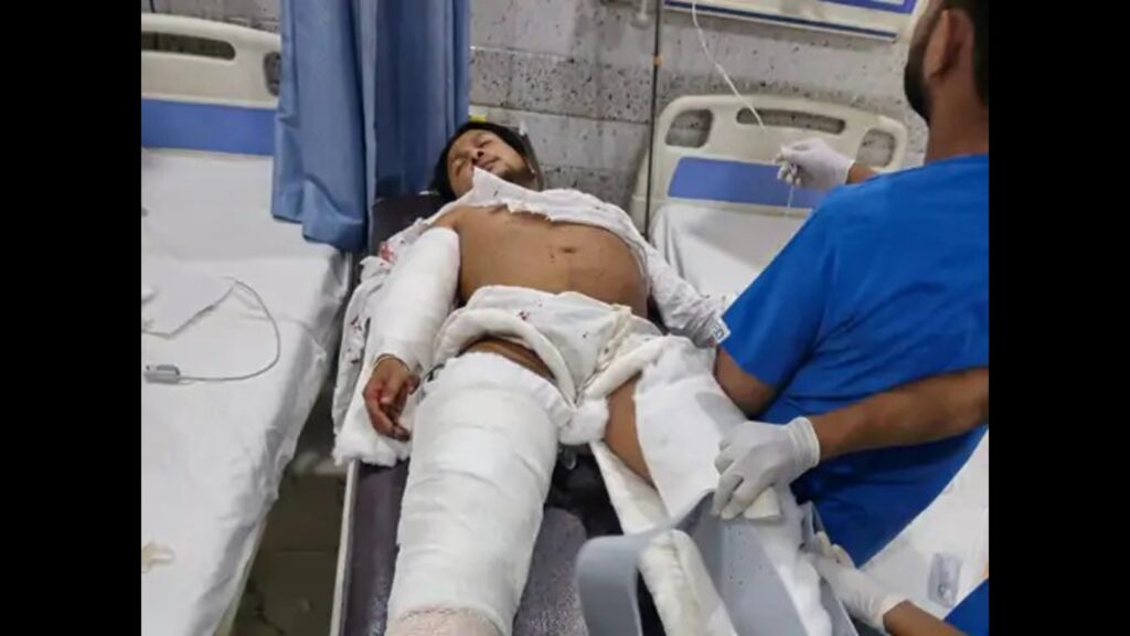 Indian Idol 12 winner Pawandeep seriously injured in mishap