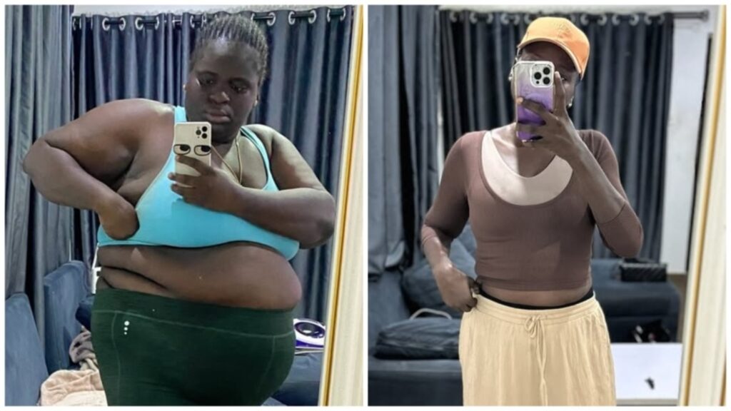 Woman who lost 95 kg credits skipping at home for her rapid weight loss without gym: ‘Jumping rope works like magic’ | Health